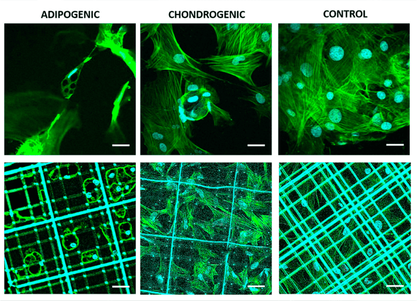 Liệu pháp tế bào gốc giúp giảm nguy cơ suy tim
